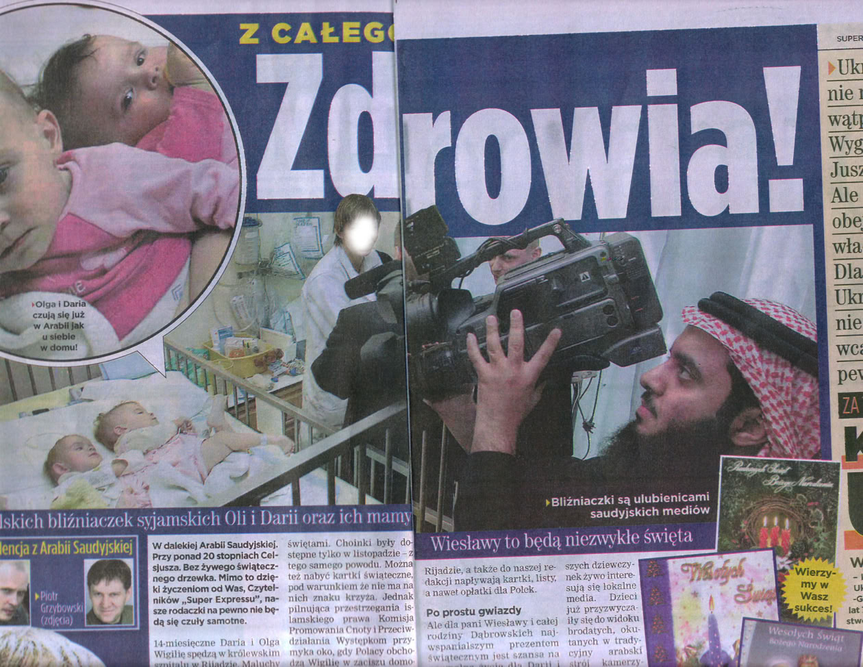 التوأم محبوبتان من وسائل الإعلام السعودية